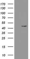 HEK293T cells were transfected with the pCMV6-ENTRY control (Left lane) or pCMV6-ENTRY PHKG2 (Right lane) cDNA for 48 hrs and lysed