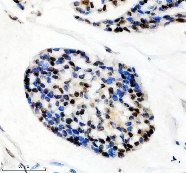 IHC analysis of HTSF1 using anti-HTSF1 antibody (M07890)