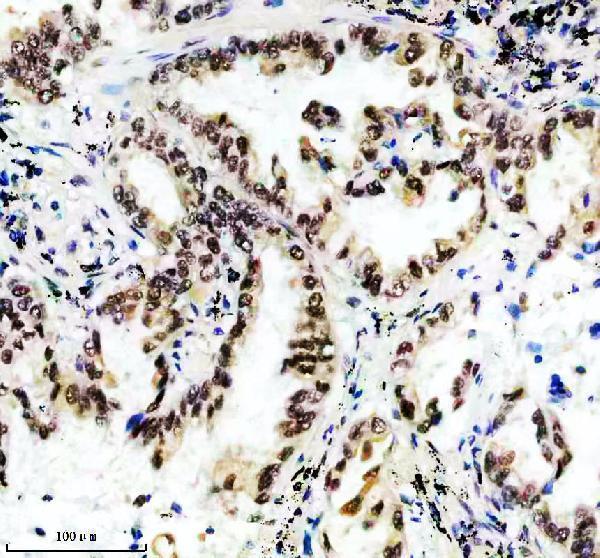 IHC analysis of HTSF1 using anti-HTSF1 antibody (M07890)