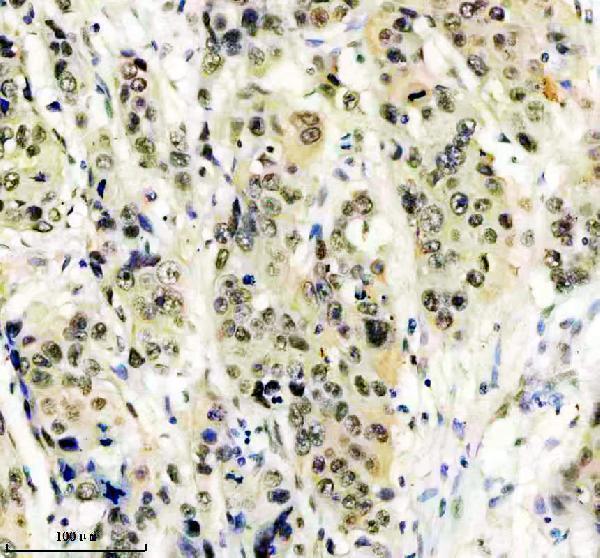 m07890 htsf1 primary antibodies ihc testing 3