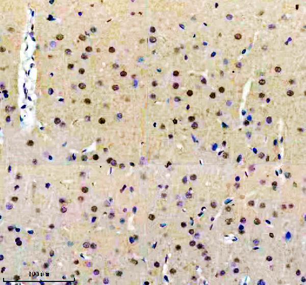 m07890 htsf1 primary antibodies ihc testing 7