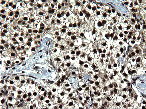 m07903 anti c20orf77 mouse monoclonal antibody clone id oti1c7 ihc testing 11