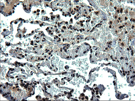 m07903 anti c20orf77 mouse monoclonal antibody clone id oti1c7 ihc testing 12