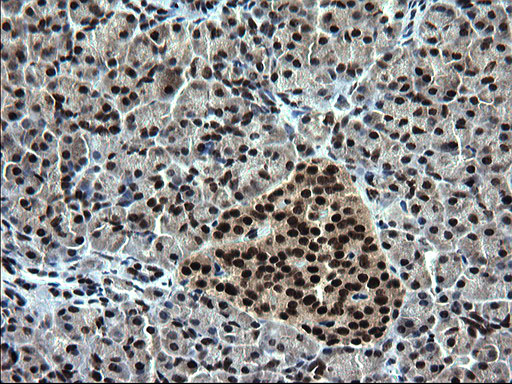 Immunohistochemical staining of paraffin-embedded Human pancreas tissue within the normal limits using anti-RPRD1B mouse monoclonal antibody