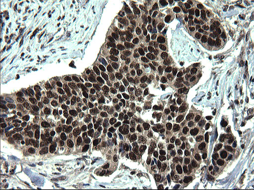 m07903 anti c20orf77 mouse monoclonal antibody clone id oti1c7 ihc testing 6