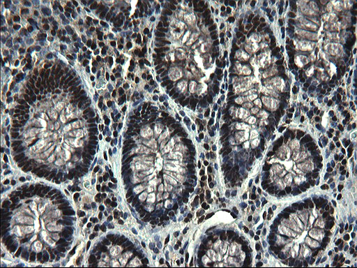 m07903 anti c20orf77 mouse monoclonal antibody clone id oti1c7 ihc testing 8
