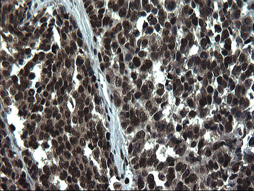m07903 anti c20orf77 mouse monoclonal antibody clone id oti1c7 ihc testing 9