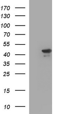 HEK293T cells were transfected with the pCMV6-ENTRY control (Left lane) or pCMV6-ENTRY RPRD1B (Right lane) cDNA for 48 hrs and lysed