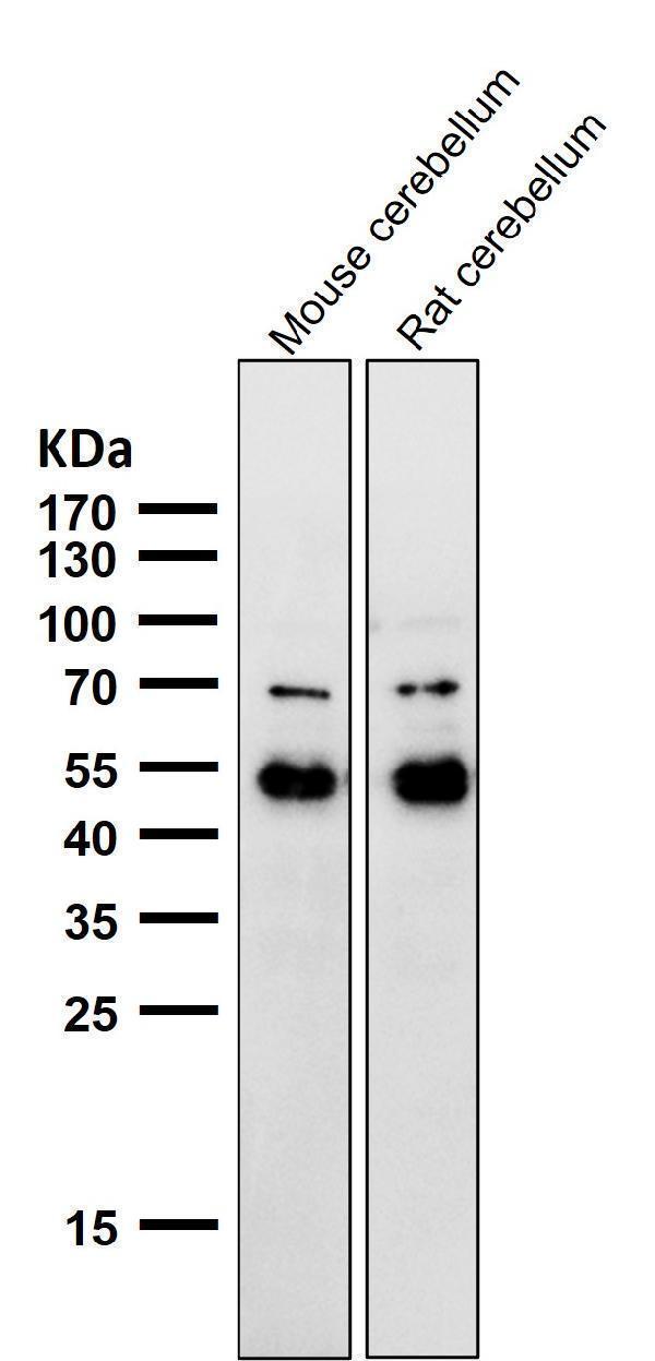 All lanes use the Antibody at 1:1K dilution for 1 hour at room temperature
