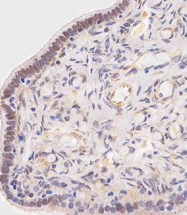 m07911 anti ovgp1 antibody n term ihc p testing 2