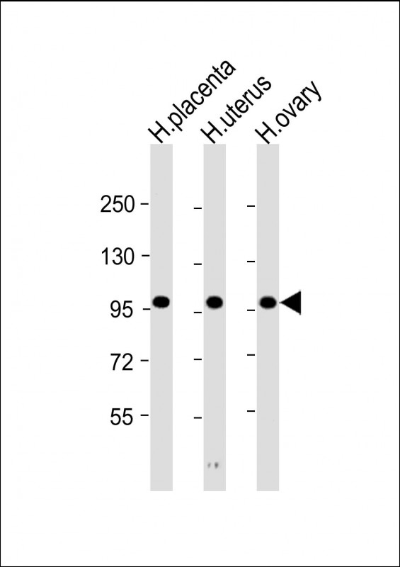 m07911 anti ovgp1 antibody n term wb testing 1