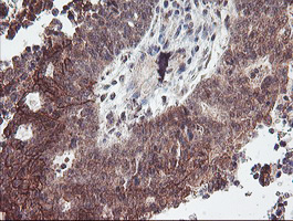 m07934 anti rfxank mouse monoclonal antibody clone id oti3e7 ihc testing 2