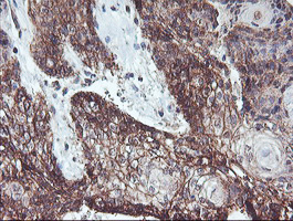 m07934 anti rfxank mouse monoclonal antibody clone id oti3e7 ihc testing 5