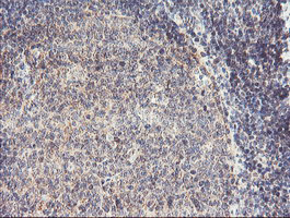 m07934 anti rfxank mouse monoclonal antibody clone id oti3e7 ihc testing 6