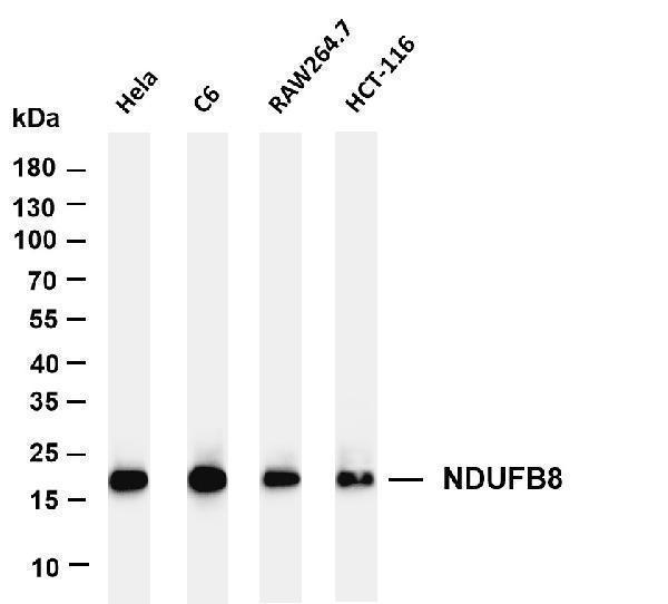 m07936 2 ndufb8 primary antibodies wb testing 1