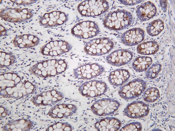 m07937 1 uqcrc2 primary antibodies ihc testing 4