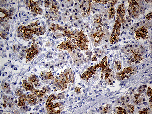 Immunohistochemical staining of paraffin-embedded Human pancreas tissue within the normal limits using anti-LAD1 mouse monoclonal antibody