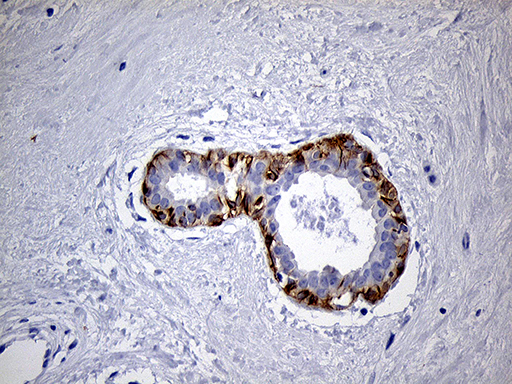 m07940 anti lad1 mouse monoclonal antibody clone id oti7h8 ihc testing 4
