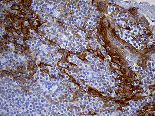 m07940 anti lad1 mouse monoclonal antibody clone id oti7h8 ihc testing 5