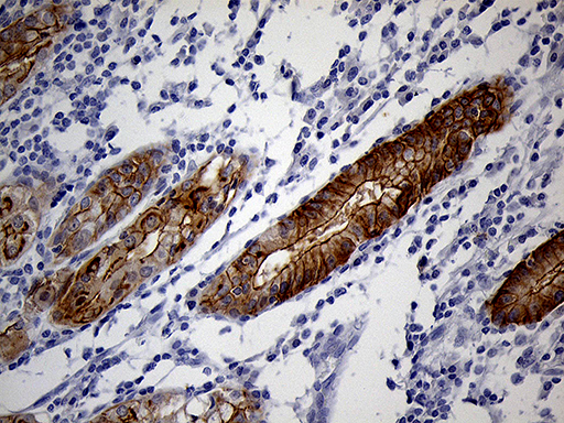m07940 anti lad1 mouse monoclonal antibody clone id oti7h8 ihc testing 6