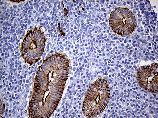 m07940 anti lad1 mouse monoclonal antibody clone id oti7h8 ihc testing 7