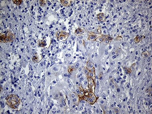 m07940 anti lad1 mouse monoclonal antibody clone id oti7h8 ihc testing 8