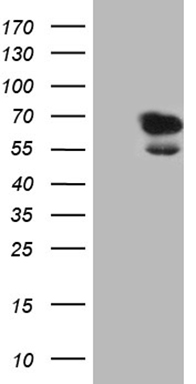 HEK293T cells were transfected with the pCMV6-ENTRY control (Left lane) or pCMV6-ENTRY LAD1 (Right lane) cDNA for 48 hrs and lysed