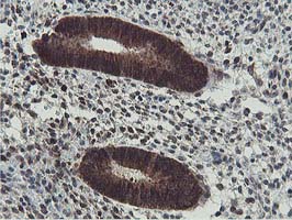 m07945 anti hexo eri1 mouse monoclonal antibody clone id oti1b3 ihc testing 3