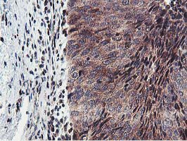 m07945 anti hexo eri1 mouse monoclonal antibody clone id oti1b3 ihc testing 4