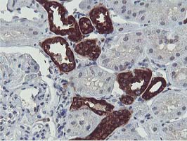 m07945 anti hexo eri1 mouse monoclonal antibody clone id oti1b3 ihc testing 6