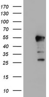 m07945 anti hexo eri1 mouse monoclonal antibody clone id oti1b3 wb testing 1
