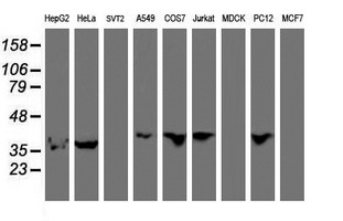 m07945 anti hexo eri1 mouse monoclonal antibody clone id oti1b3 wb testing 2