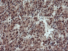 m07953 anti trip traip mouse monoclonal antibody clone id oti2d4 ihc testing 11