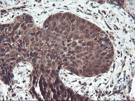 m07953 anti trip traip mouse monoclonal antibody clone id oti2d4 ihc testing 2