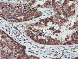 m07953 anti trip traip mouse monoclonal antibody clone id oti2d4 ihc testing 3