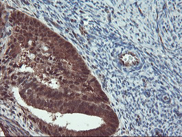m07953 anti trip traip mouse monoclonal antibody clone id oti2d4 ihc testing 4
