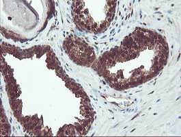 m07953 anti trip traip mouse monoclonal antibody clone id oti2d4 ihc testing 5