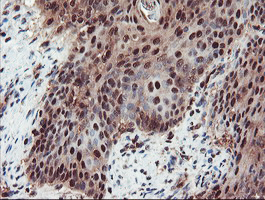 m07953 anti trip traip mouse monoclonal antibody clone id oti2d4 ihc testing 6
