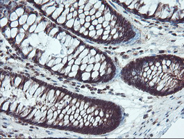 m07953 anti trip traip mouse monoclonal antibody clone id oti2d4 ihc testing 7