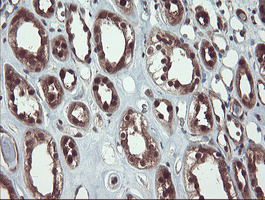 m07953 anti trip traip mouse monoclonal antibody clone id oti2d4 ihc testing 8