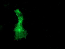 m07956 anti dok2 mouse monoclonal antibody clone id oti1a4 if testing 3
