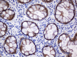 m07962 1 anti cmpk1 mouse monoclonal antibody clone id oti2a2 ihc testing 4