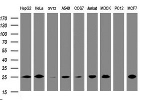 m07962 1 anti cmpk1 mouse monoclonal antibody clone id oti2a2 wb testing 2