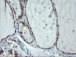 m07962 anti cmpk1 mouse monoclonal antibody clone id oti1a1 ihc testing 4