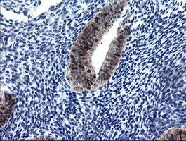 m07962 anti cmpk1 mouse monoclonal antibody clone id oti1a1 ihc testing 5