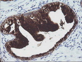 m07962 anti cmpk1 mouse monoclonal antibody clone id oti1a1 ihc testing 6