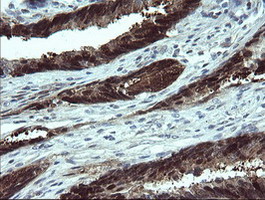 m07962 anti cmpk1 mouse monoclonal antibody clone id oti1a1 ihc testing 8