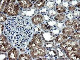 m07962 anti cmpk1 mouse monoclonal antibody clone id oti1a1 ihc testing 9