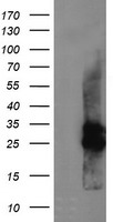 HEK293T cells were transfected with the pCMV6-ENTRY control (Left lane) or pCMV6-ENTRY CMPK1 (Right lane) cDNA for 48 hrs and lysed