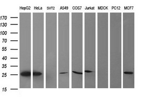 Western blot analysis of extracts (35ug) from 9 different cell lines by using anti-CMPK1 monoclonal antibody (HepG2: human; HeLa: human; SVT2: mouse; A549: human; COS7: monkey; Jurkat: human; MDCK: canine; PC12: rat; MCF7: human)